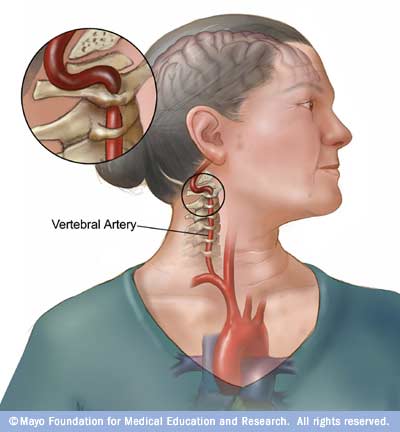 Nạn nhân sau đột quỵ có giọng nói khác thường